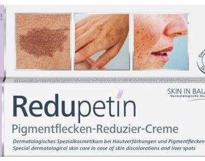Redupetin krém pigmentové škvrny nočný 20 ml